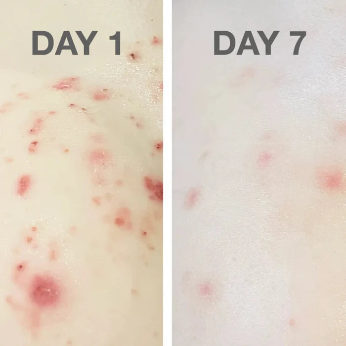 Go-For-Zero-Australia-The-Physic-Garden-Australia-Skin-Rescue-Skin